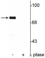 Phospho-Synapsin 1 (Ser9) Polyclonal Antibody