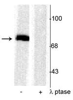 Phospho-Synapsin 1 (Ser603) Polyclonal Antibody