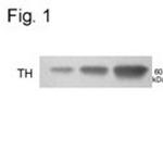 Phospho-Tyrosine Hydroxylase (Ser40) Antibody in Western Blot (WB)