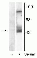 Phospho-MEK1/MEK2 (Ser218, Ser222) Antibody in Western Blot (WB)