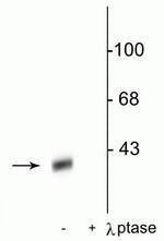 Phospho-DARPP-32 (Thr34) Polyclonal Antibody
