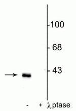 Phospho-DARPP-32 (Thr75) Polyclonal Antibody