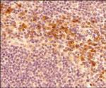 HRD1 Antibody in Immunohistochemistry (Paraffin) (IHC (P))