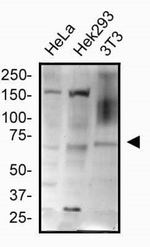 HRD1 Antibody in Western Blot (WB)