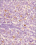 FOXP3 Antibody in Immunohistochemistry (Paraffin) (IHC (P))
