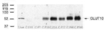 GLUT10 Antibody in Western Blot (WB)