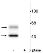 Phospho-CaMKII alpha/beta (Thr286) Polyclonal Antibody