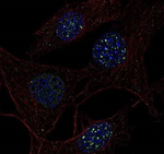 53BP1 Antibody in Immunocytochemistry (ICC/IF)