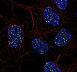 53BP1 Antibody in Immunocytochemistry (ICC/IF)