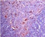 alpha-2c Adrenergic Receptor Antibody in Immunohistochemistry (IHC)