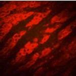 P2Y2 Antibody in Immunohistochemistry (IHC)