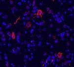 mGluR1 Polyclonal Antibody