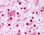 DISC1 Antibody in Immunohistochemistry (Paraffin) (IHC (P))
