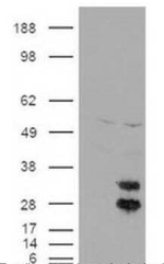 Fe65 Antibody in Western Blot (WB)