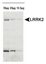 LRRK2 Antibody in Western Blot (WB)
