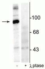 Phospho-Dynamin 1 (Ser774) Polyclonal Antibody