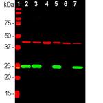 PGP9.5 Antibody in Western Blot (WB)