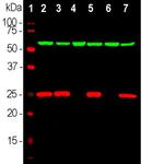 PGP9.5 Antibody in Western Blot (WB)