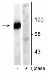 Phospho-Dynamin 1 (Ser778) Polyclonal Antibody