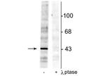 Phospho-EphB2 (Tyr298) Polyclonal Antibody