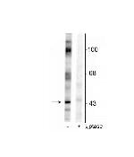 Phospho-EphB2 (Tyr317) Polyclonal Antibody