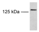 TRPM8 Antibody in Western Blot (WB)