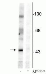 Phospho-EphB2 (Tyr331) Polyclonal Antibody