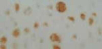 NF1 Antibody in Immunohistochemistry (Paraffin) (IHC (P))