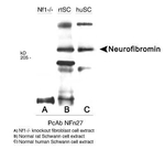NF1 Antibody in Western Blot (WB)