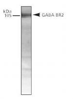 GABBR2 Polyclonal Antibody