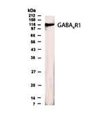 GABBR1 Polyclonal Antibody