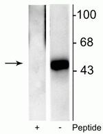 Phospho-ELK1 (Ser383) Polyclonal Antibody