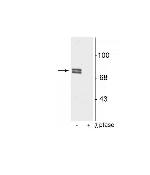 Phospho-ALOX5 (Ser523) Polyclonal Antibody