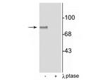 Phospho-MARCKS (Ser152, Ser156) Polyclonal Antibody