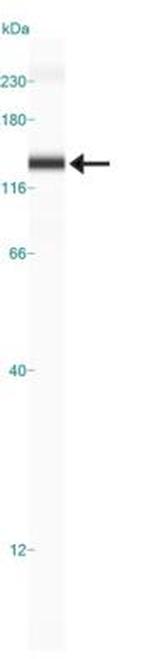 EPB41L3 Polyclonal Antibody