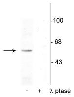 Phospho-p53 (Ser392) Polyclonal Antibody