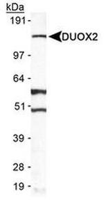 DUOX2 Antibody in Western Blot (WB)