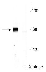 Phospho-PAK1/2/3 (Thr402) Polyclonal Antibody
