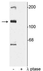 Phospho-TAOK2 (Ser181) Polyclonal Antibody