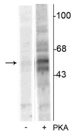 Phospho-TPH1 (Ser58) Polyclonal Antibody