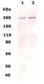 LRRK2 Antibody in Western Blot (WB)