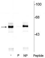 Phospho-TPH1 (Ser260) Polyclonal Antibody