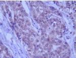 Beclin 1 Antibody in Immunohistochemistry (IHC)