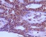 Beclin 1 Antibody in Immunohistochemistry (IHC)