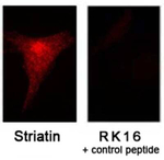 STRN Antibody in Immunocytochemistry (ICC/IF)