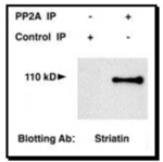 STRN Antibody in Western Blot (WB)