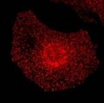 EPS15 Antibody in Immunocytochemistry (ICC/IF)
