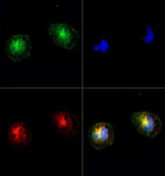 TRPM2 Antibody in Immunocytochemistry (ICC/IF)