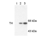 Phospho-Tyrosine Hydroxylase (Ser19) Antibody in Western Blot (WB)