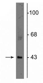 Connexin 43 Polyclonal Antibody